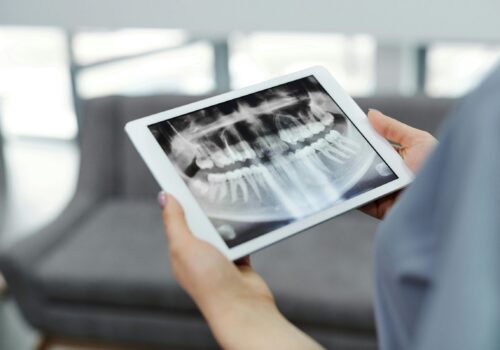 RTG cyfrowe – szybka i precyzyjna diagnostyka stomatologiczna